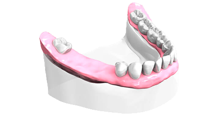 Examen pré-implantaire - Clinique Dentaire Elysées Ponthieu - Dentiste Paris 8