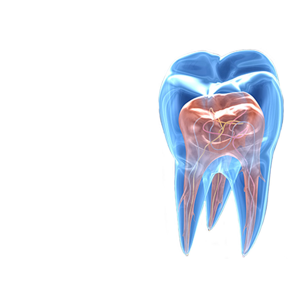 Endodontie - Clinique Dentaire Elysées Ponthieu - Dentiste Paris 8