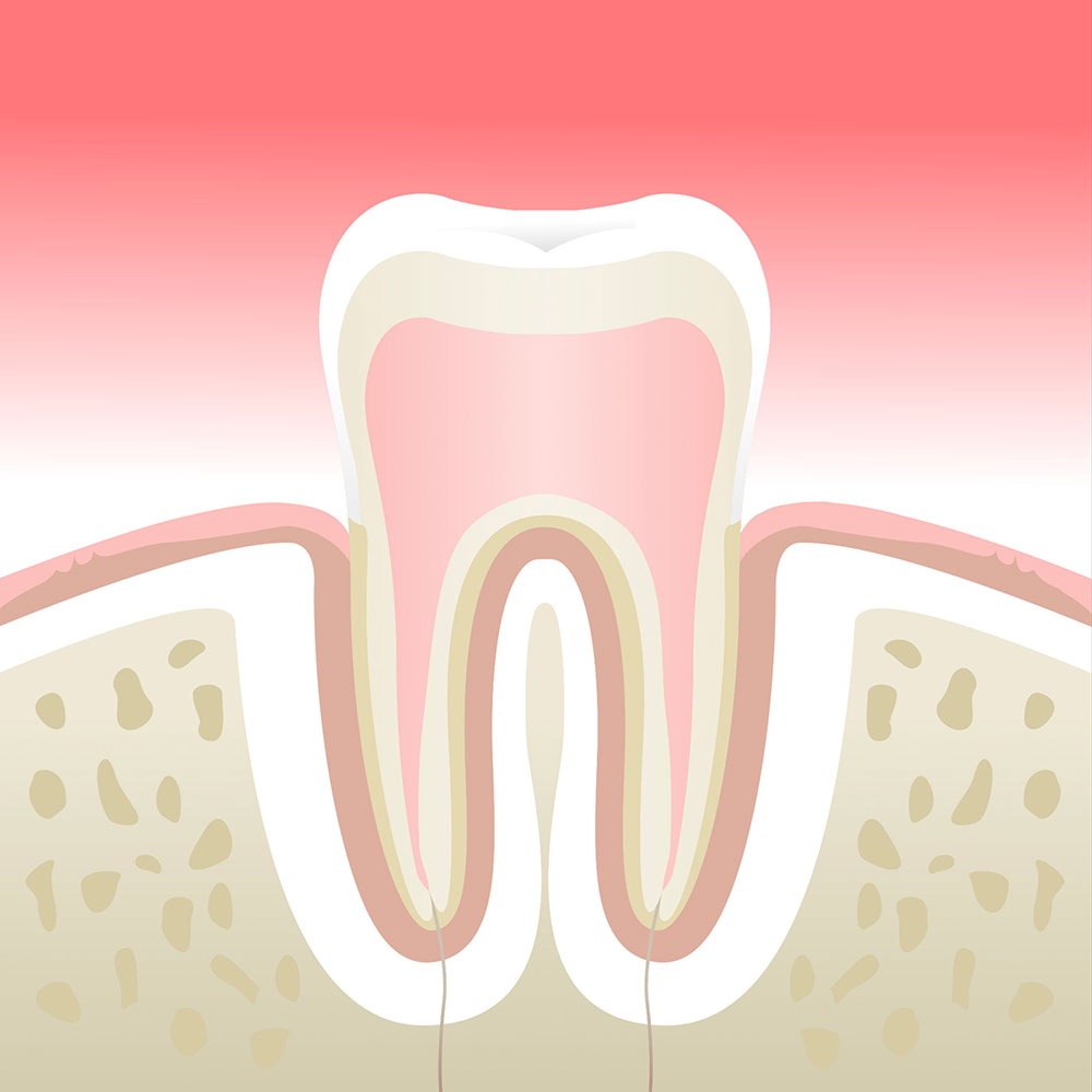 Parodontite - Clinique Dentaire Elysées Ponthieu - Dentiste Paris 8